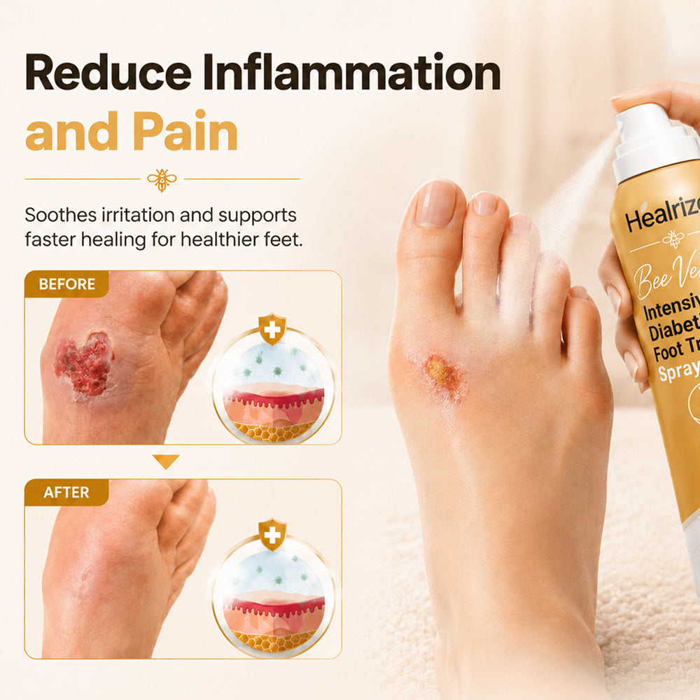 🎉Limited-time discount🎉Healrize®Bee Venom Intensive Diabetic Foot Treatment Spray🔥89K+SOLD🔥