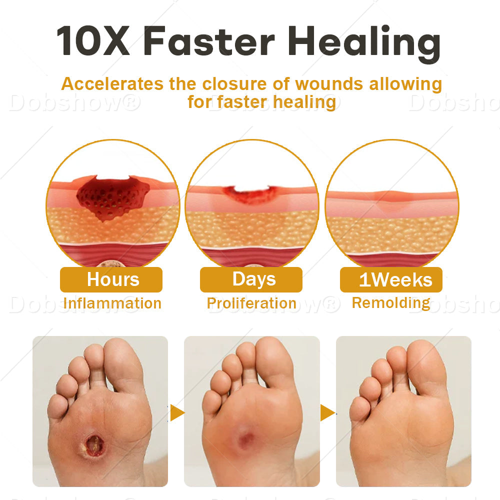 ✨Best Seller🔥Healrize® GlucoShield Bee Venom Wound Spray 🎉Special limited-time discount