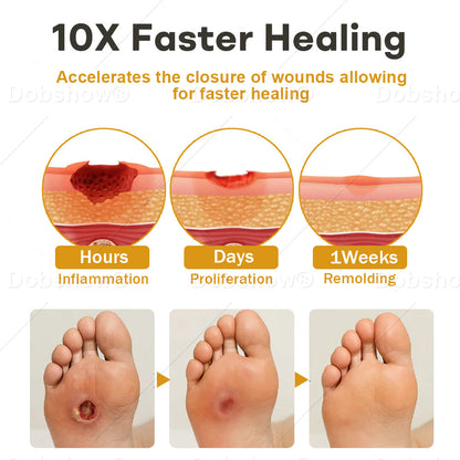 ✨Best Seller🔥Healrize® GlucoShield Bee Venom Wound Spray 🎉Special limited-time discount