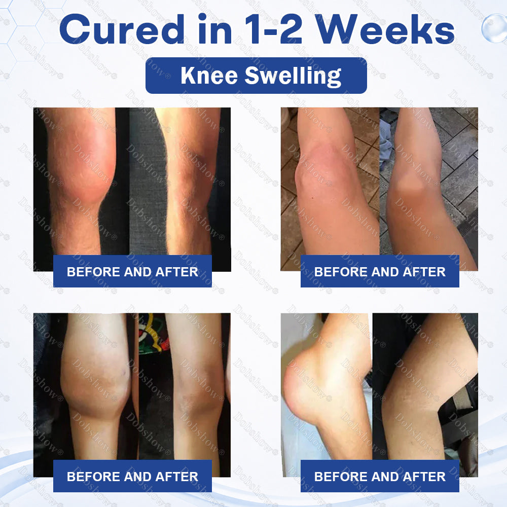 🏆𝐎𝐟𝐟𝐢𝐜𝐢𝐚𝐥 𝐔𝐒 𝐒𝐭𝐨𝐫𝐞-🎉Limited Time Offer⏳Healrize® Knee Joint Pain Relief Patches-Soothes Inflammation, Reduces Pain,  Boosts Recovery-🔥Bestseller - 🌍 Global Shipping