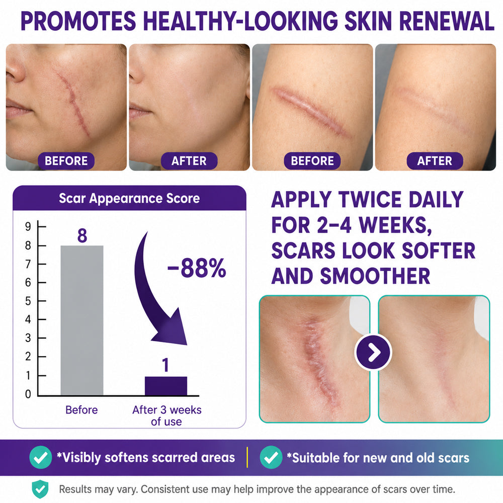 🔥89K+SOLD🔥Dobshow® Allantoin Scar Gel🎉Limited-time discount🎉