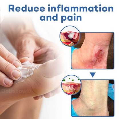 `Healrize®  Diabetic Foot Uicer Healing Cream