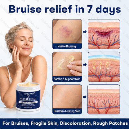 🔥89K+SOLD🔥Dobshow® BruiseShield Skin Strengthening Cream🎉Limited-time discount