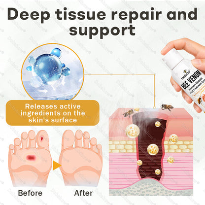 🎊Special limited-time discount-Healrize® Bee Venom Intensive Diabetic Foot Treatment Spray🔥Best Seller🔥