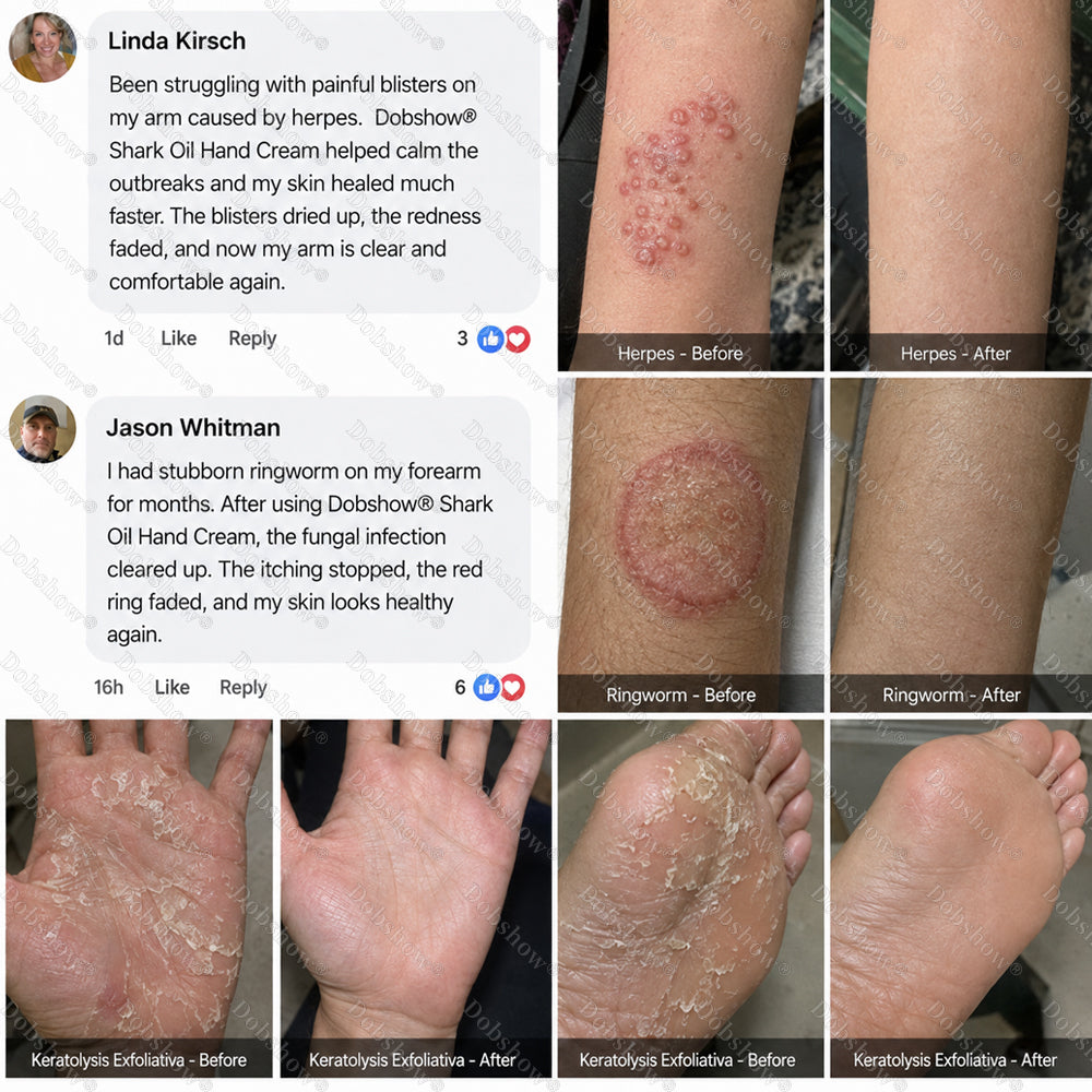`Dobshow® Shark Oil Hand Cream