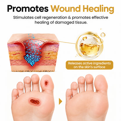 🎉Limited-time discount🎉Healrize®Bee Venom Intensive Diabetic Foot Treatment Spray🔥89K+SOLD🔥