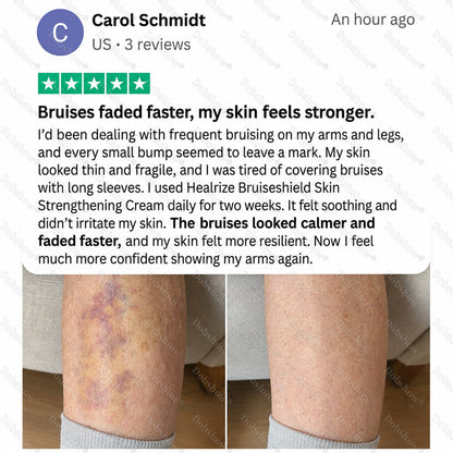 🔥89K+SOLD🔥Dobshow® BruiseShield Skin Strengthening Cream🎉Limited-time discount