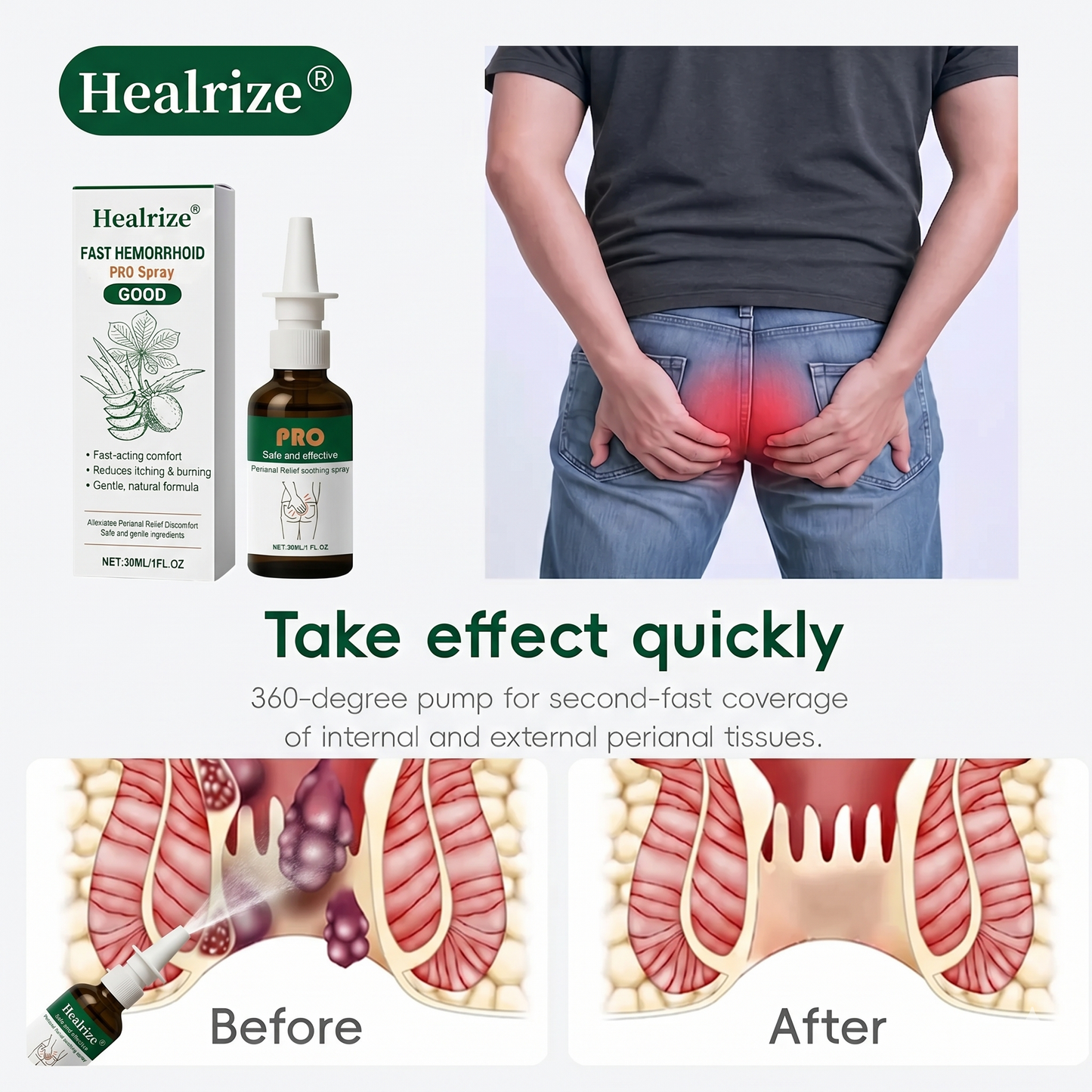 Healrize® Fast Hemorrhoid PRO Spray