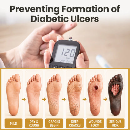 🎉Limited-time discount🎉Healrize®Bee Venom Intensive Diabetic Foot Treatment Spray🔥89K+SOLD🔥