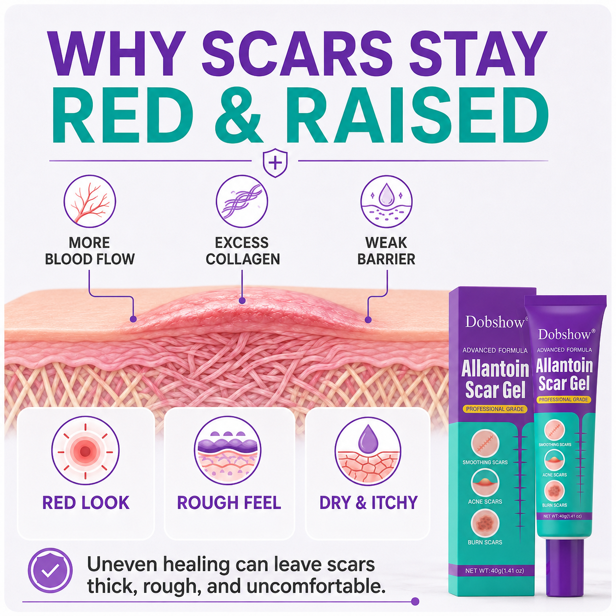 Dobshow® Allantoin Scar Gel