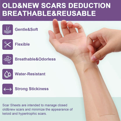 `Dobshow® Silicone Scar Gel Sheet Roll