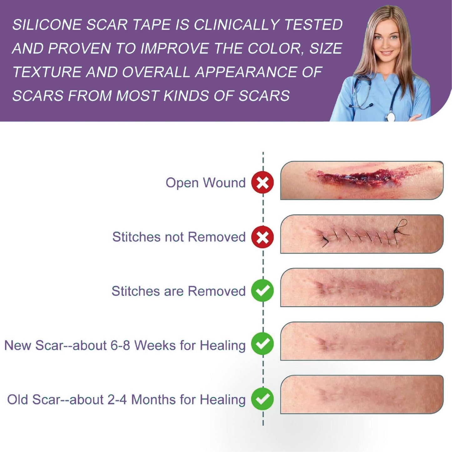 `Dobshow® Silicone Scar Gel Sheet Roll