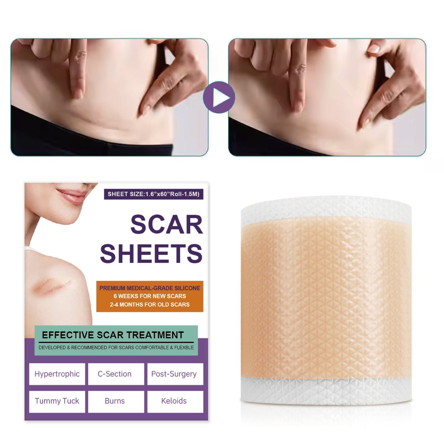 `Dobshow® Silicone Scar Gel Sheet Roll