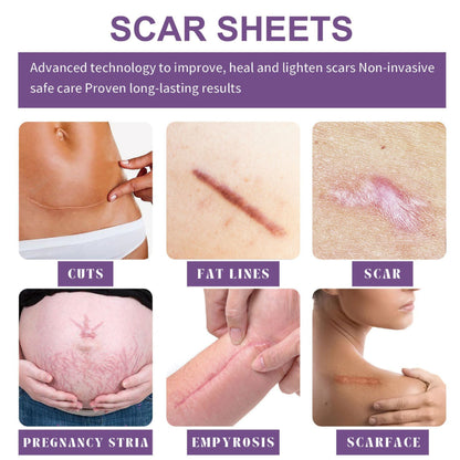`Dobshow® Silicone Scar Gel Sheet Roll